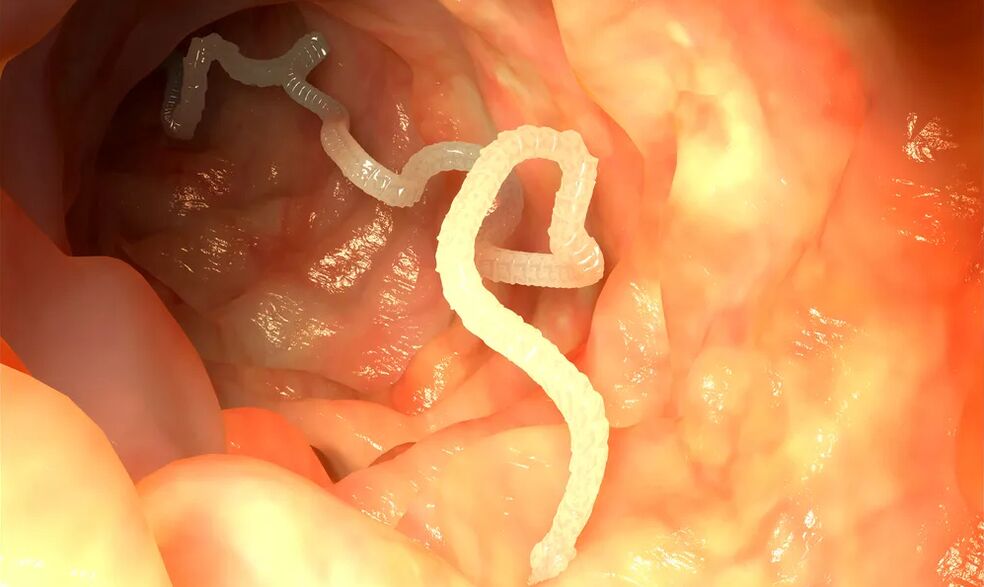 I vermi luminali infettano l'intestino