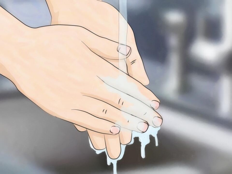 Per evitare l'infestazione da vermi, pratica una buona igiene e lavati le mani. 