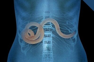 Parassiti nel corpo umano