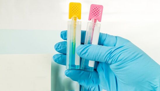 Metodi di diagnostica parassita