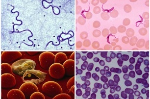 Quali parassiti possono essere nel sangue umano