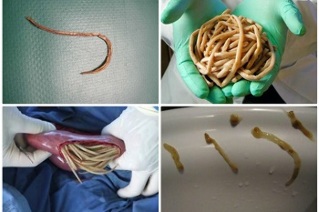 Quali parassiti possono vivere nell'intestino umano